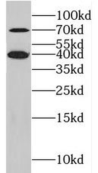 KLHL14 Antibody