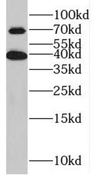 KLHL14 Antibody