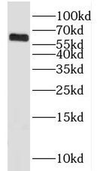 KLHL18 Antibody