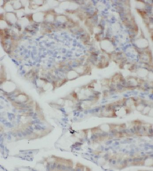 KLHL18 Antibody