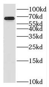 KLHL2 Rabbit Polyclonal Antibody