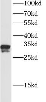KLK3 Mouse Monoclonal Antibody