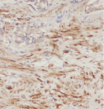 KLK3 Mouse Monoclonal Antibody