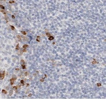 KLRF1 Antibody