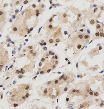 KPNA4 Antibody