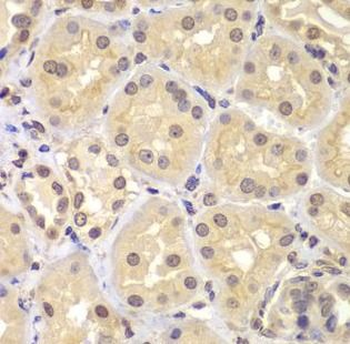 KPNA6 Antibody