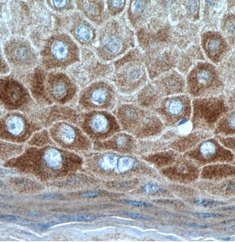 KRT34 Antibody
