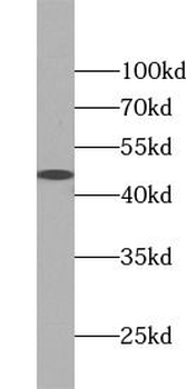 KRT40 Antibody
