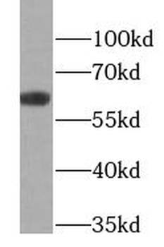 KRT6B Rabbit Polyclonal Antibody