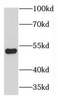 KRT80 Rabbit Polyclonal Antibody