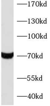 XRCC6 Rabbit Polyclonal Antibody
