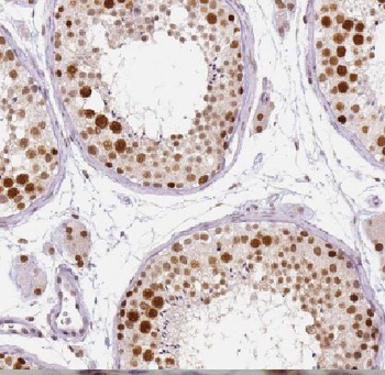 XRCC6 Antibody