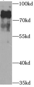 KCND2 Antibody