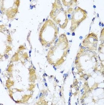 KCND2 Antibody