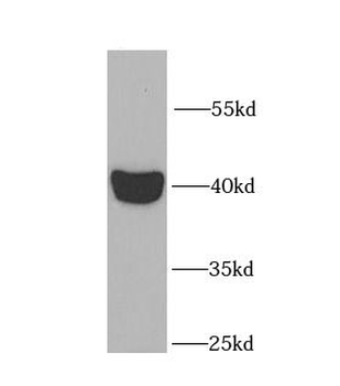 L2HGDH Antibody