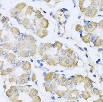 L2HGDH Antibody