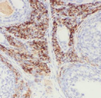 LAMA4 Antibody