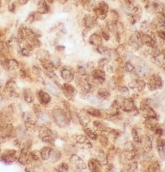 LMNA Rabbit Polyclonal Antibody