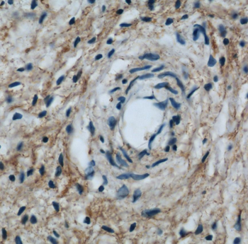 LAMP2 Antibody