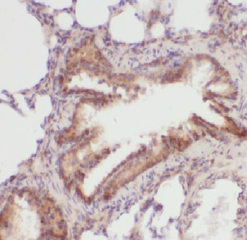 LAMP3 Antibody