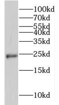 LAPTM4B Rabbit Polyclonal Antibody