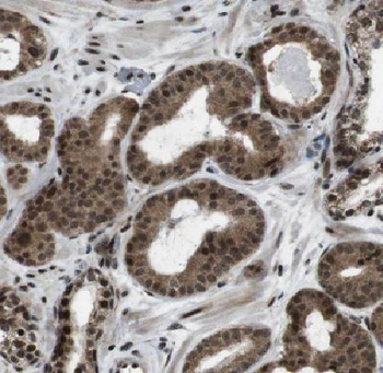 ARHGEF12 Antibody
