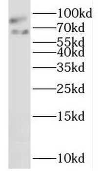 LAS1L Antibody