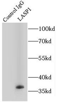 LASP1 Antibody