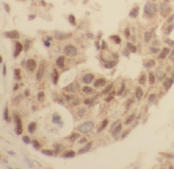 LASP1 Antibody