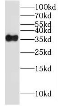 LAT Rabbit Polyclonal Antibody