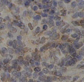 LAX1 Antibody