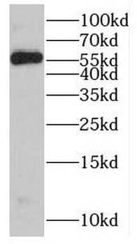 LBP Rabbit Polyclonal Antibody