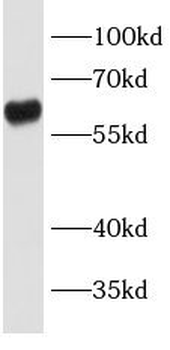 LBP Mouse Monoclonal Antibody