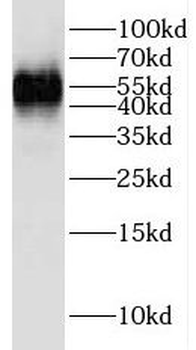 LCK Rabbit Polyclonal Antibody