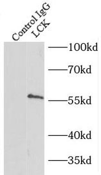 LCK Rabbit Polyclonal Antibody