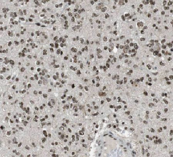 LCK Rabbit Polyclonal Antibody