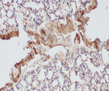 LCORL Antibody