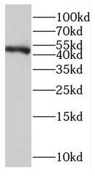 LDB1 Rabbit Polyclonal Antibody