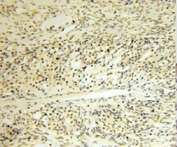 LDB1 Antibody