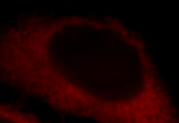 LDHA Antibody