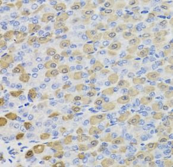 LDHB Antibody