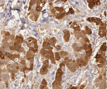LDHD Antibody