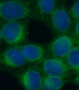 LDLR Antibody