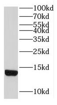 LDLRAD1 Rabbit Polyclonal Antibody