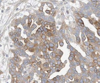 LEFTY2 Antibody