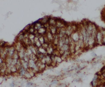 LEO1 Antibody