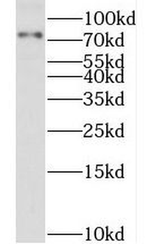 P3H2 Rabbit Polyclonal Antibody