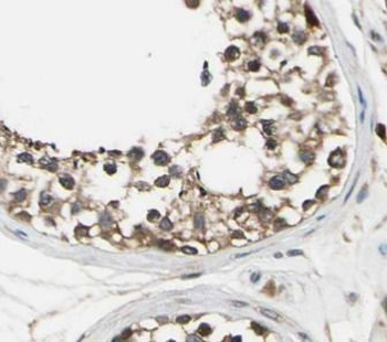 LEP Rabbit Polyclonal Antibody