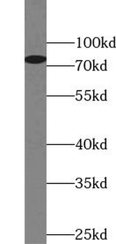 DHX58 Antibody