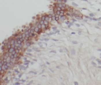 DHX58 Antibody